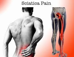 sciatica pain